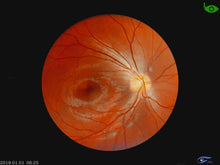 โหลดรูปภาพลงในเครื่องมือใช้ดูของ Gallery Hand-Held Fundus Camera/CFC-X