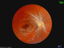 Load image into Gallery viewer, Hand-Held Fundus Camera/CFC-X