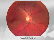Lataa kuva Galleria-katseluun, Hand-Held Fundus Camera/NME-Y