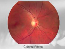 Carregar imagem no visualizador da galeria, Hand-Held Fundus Camera/NME-Y