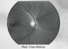 Lataa kuva Galleria-katseluun, Hand-Held Fundus Camera/NME-Y