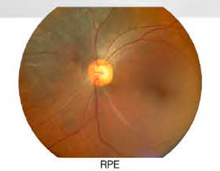 Lataa kuva Galleria-katseluun, Hand-Held Fundus Camera/NME-Y