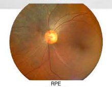 Carregar imagem no visualizador da galeria, Hand-Held Fundus Camera/NME-Y