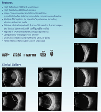 이미지를 갤러리 뷰어에 로드 , MD-2300S Ultrasonic A/B Scanner for Ophthalmology