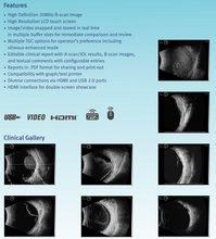 Carica l&#39;immagine nel visualizzatore di Gallery, MD-2300S Ultrasonic A/B Scanner for Ophthalmology