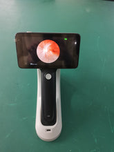 画像をギャラリービューアに読み込む, Hand-Held Fundus Camera/CFC-X